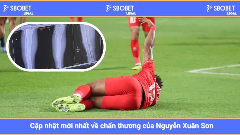 Cập nhật mới nhất về chấn thương của Nguyễn Xuân Sơn